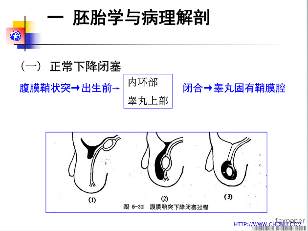 小儿腹股沟斜疝 鞘膜积液的诊断与治疗