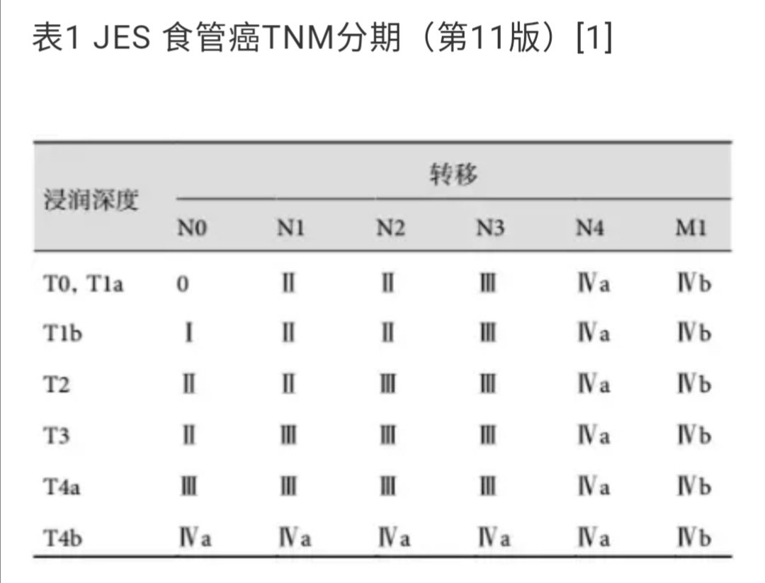 日本食管癌如何系统分期