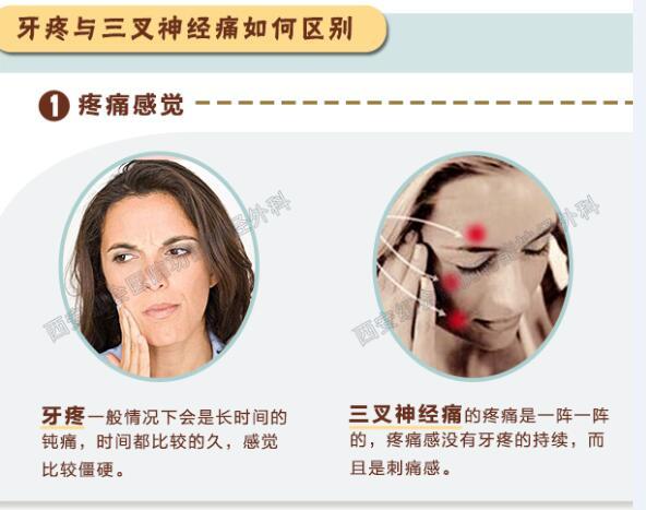 别再冤枉牙齿,一张图分清三叉神经痛和牙疼