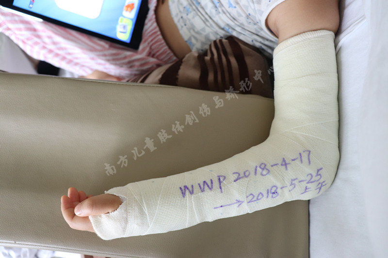 其他 石膏护理小贴士