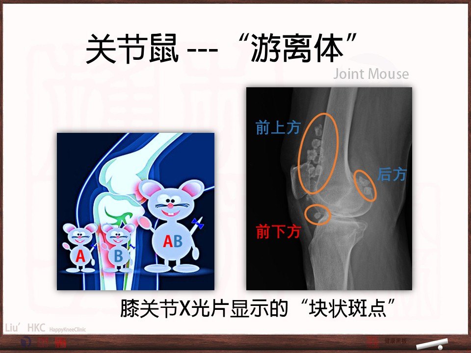 关节的空隙里都可能藏着关节鼠!