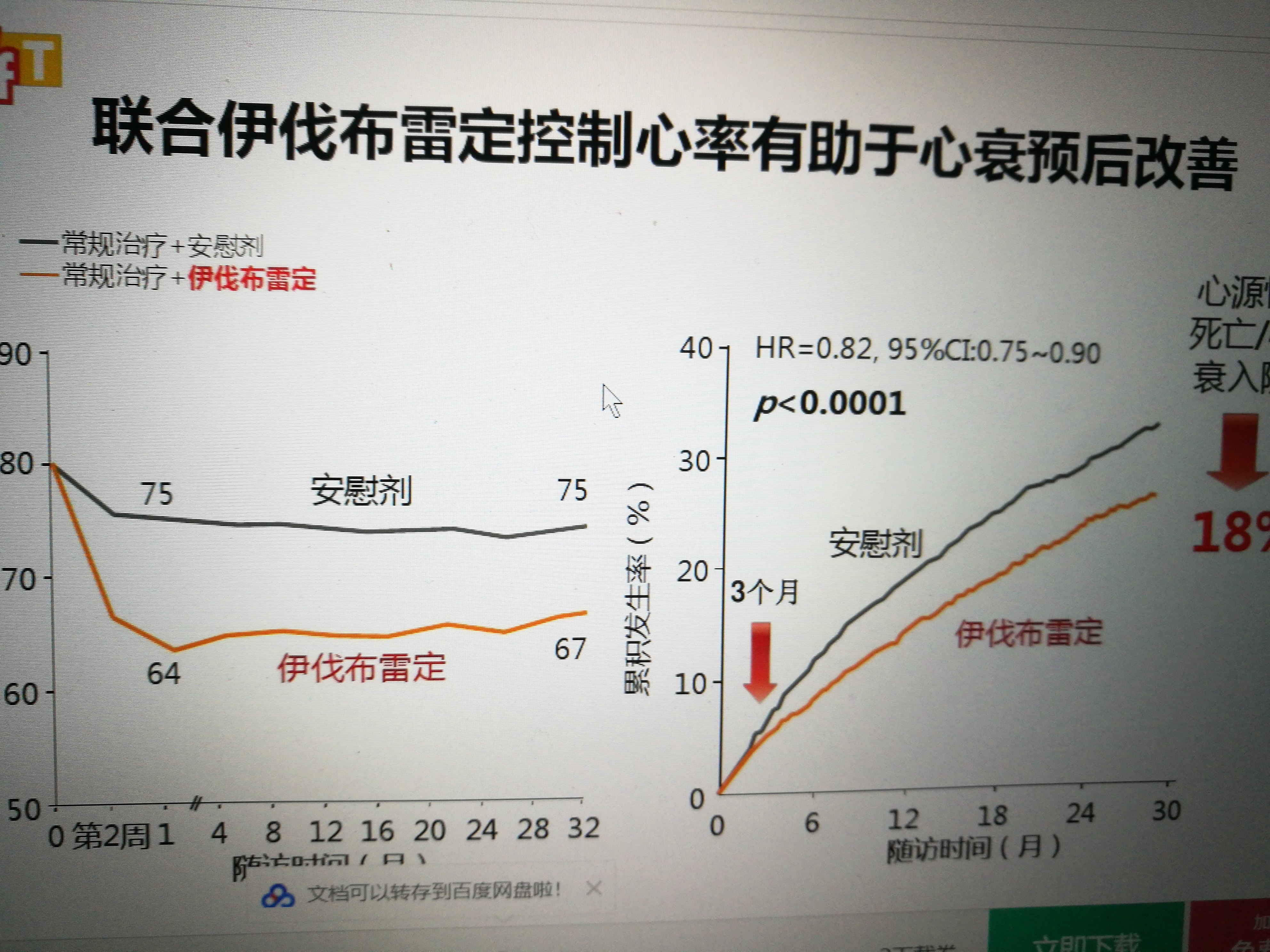 伊伐布雷定临床经验