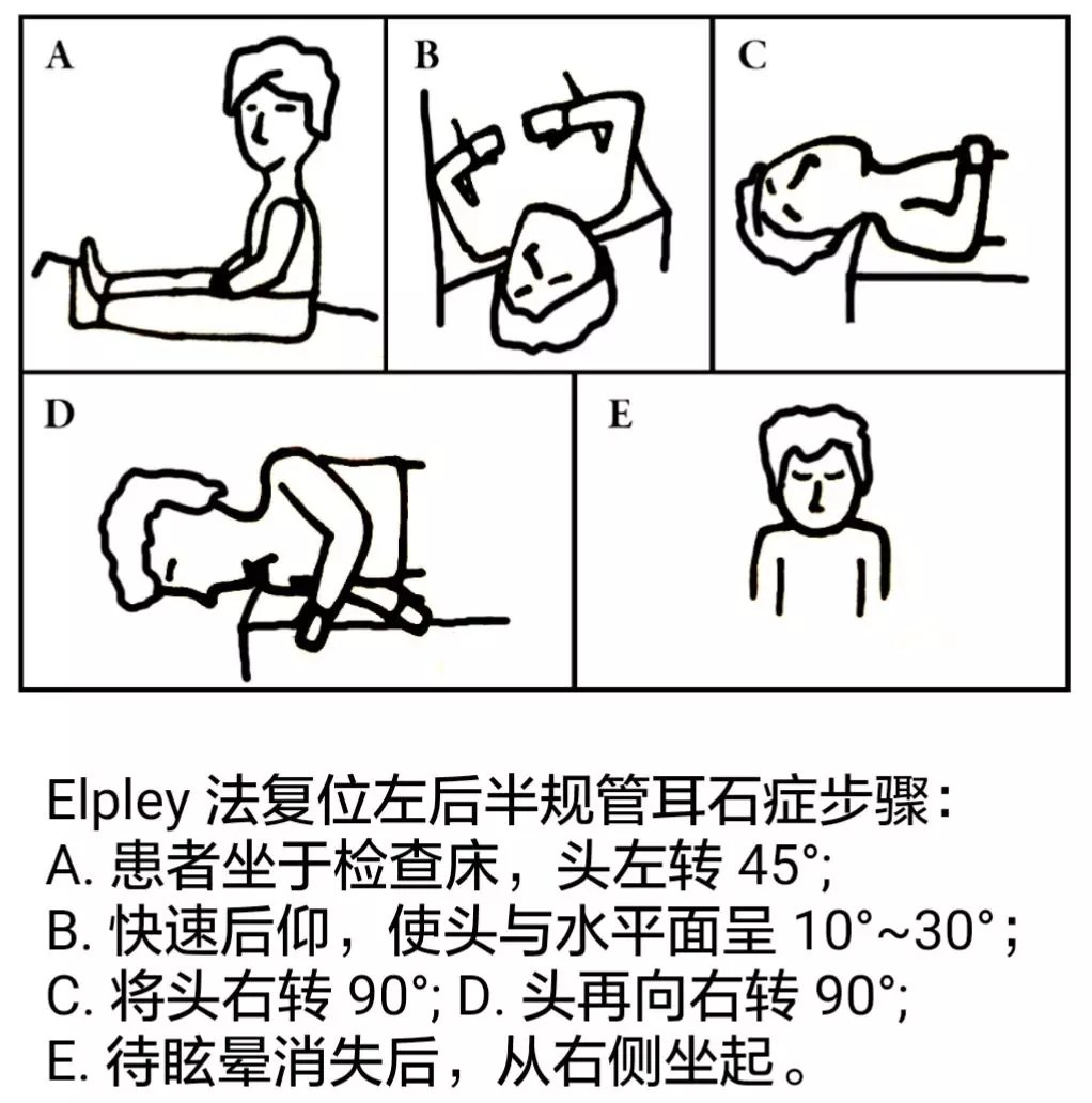 耳石症小知识