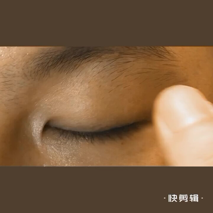 如何进行睑板腺自我按摩 先用40度热毛巾热敷眼睑五分钟;洗干净手按摩