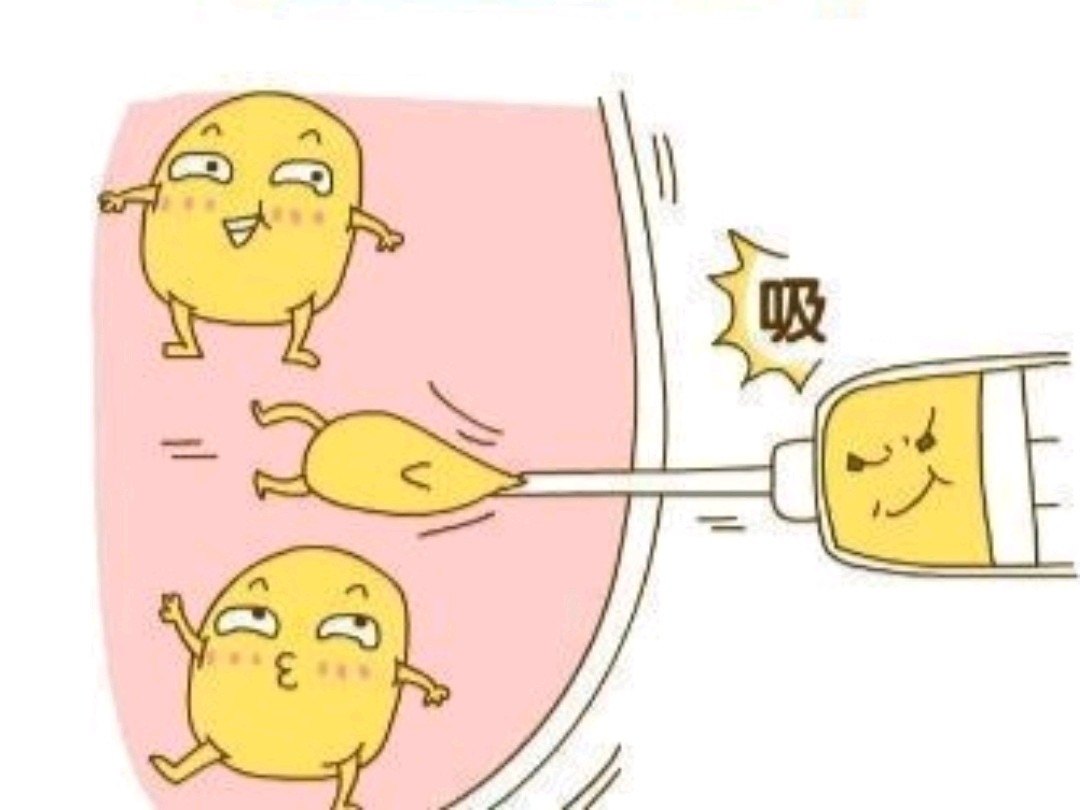 吸脂创伤吸脂量出血量