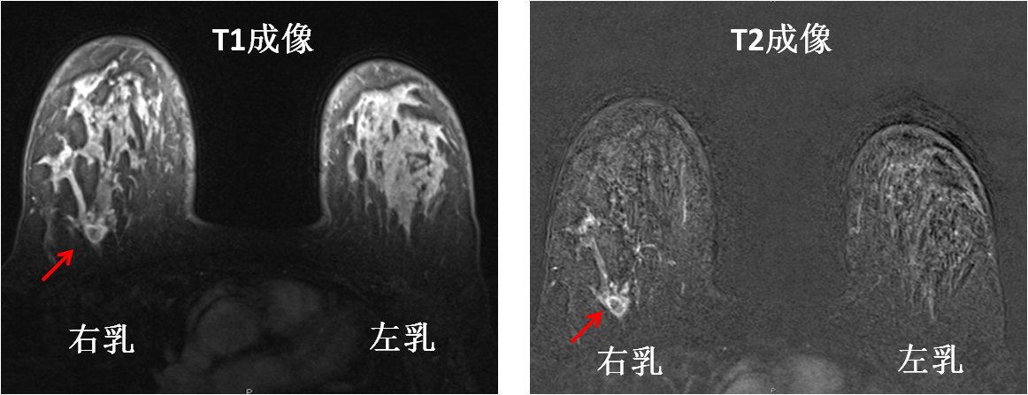 1491034957670182.png T1T2.png