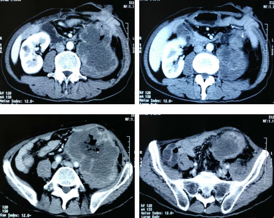 1512837885341965.png 微信截图_20171210004426.png