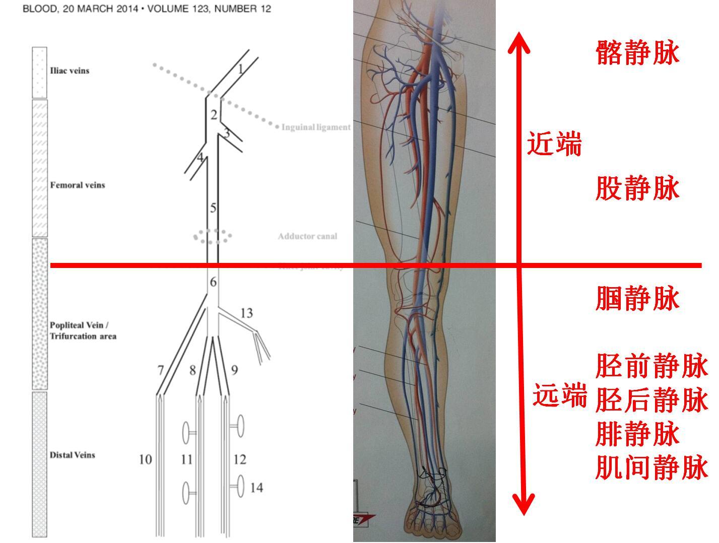 dvt分型.jpg