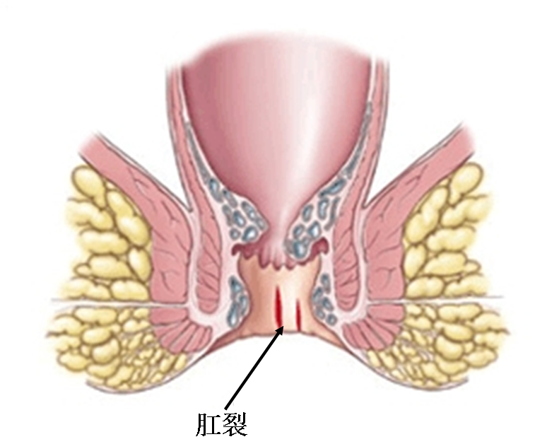 1491122923458778.png 1491122923458778.png