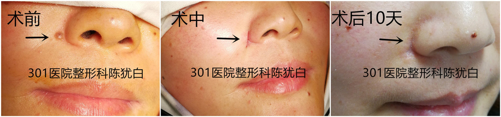 1492353782643517.jpg initpintu_副本_副本.jpg