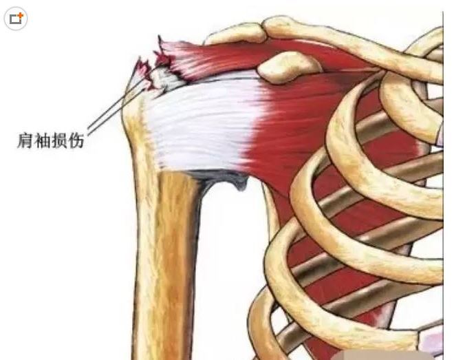 肩关节镜微创手术能治疗哪些疾病呀?_肩关节