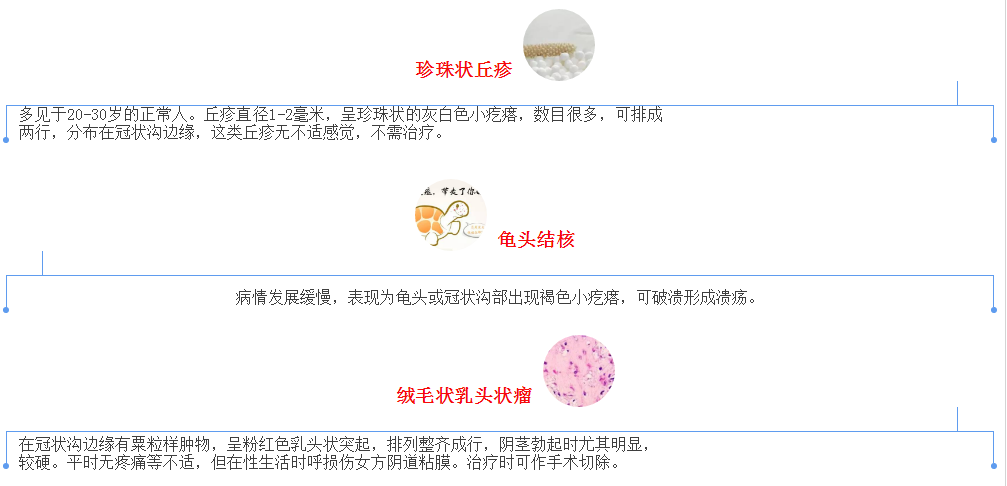 包皮上长小痘痘是怎么回事