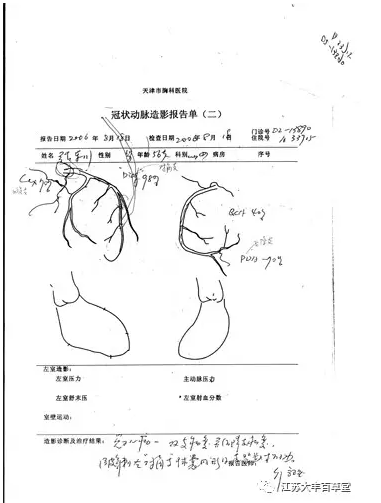 纯中药治疗冠心病有效吗?中药消除斑块靠谱吗