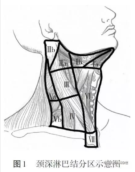 指南与共识|分化型甲状腺癌颈侧区淋巴结清扫