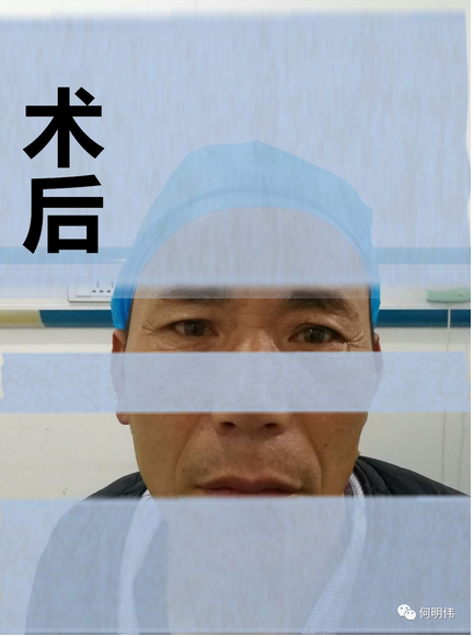 眼睛不停跳,警惕面肌痉挛 - 好大夫在线 ·智慧