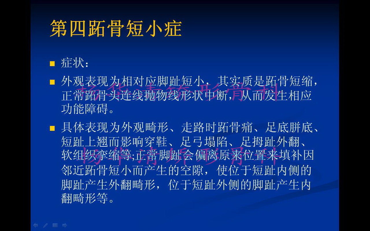 双足第四跖骨短小典型病例
