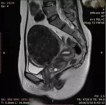 1497953073855095.png 图片.png