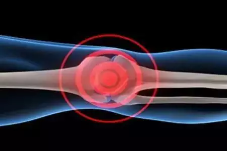 关节响,是有什么骨科疾病吗?