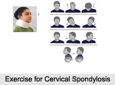 2_Exercise_for_Cervical_Spondylosis_2.jpg