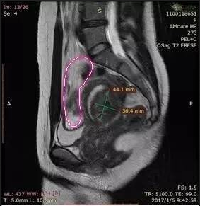 1497953085458287.png 图片.png