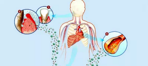 口腔卫生不好会引起这么多全身性疾病(口腔科