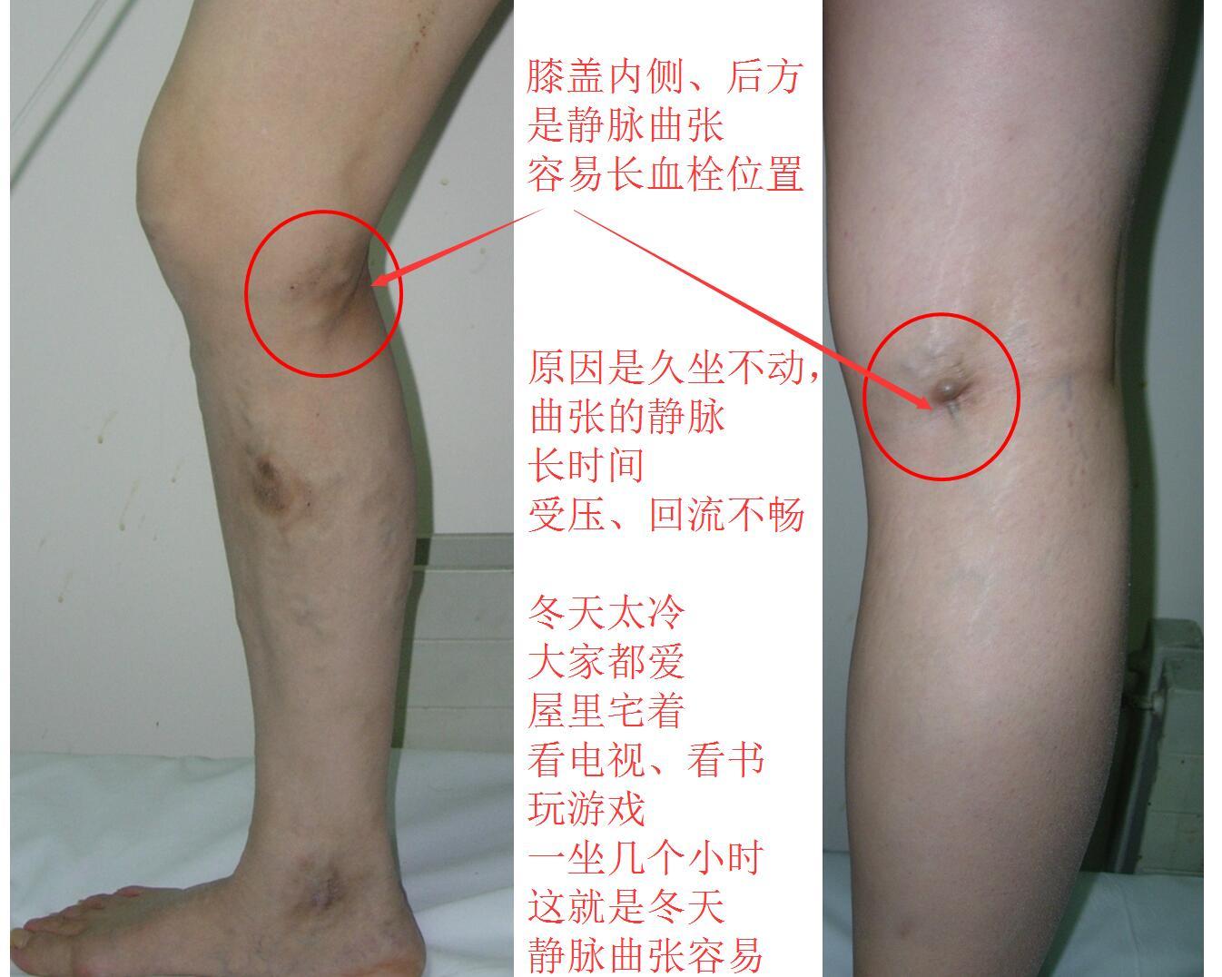 1513179949306821.jpg QQ截图20171213234255.jpg