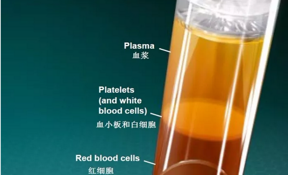 注射富血小板血浆疗法概述prptherapy