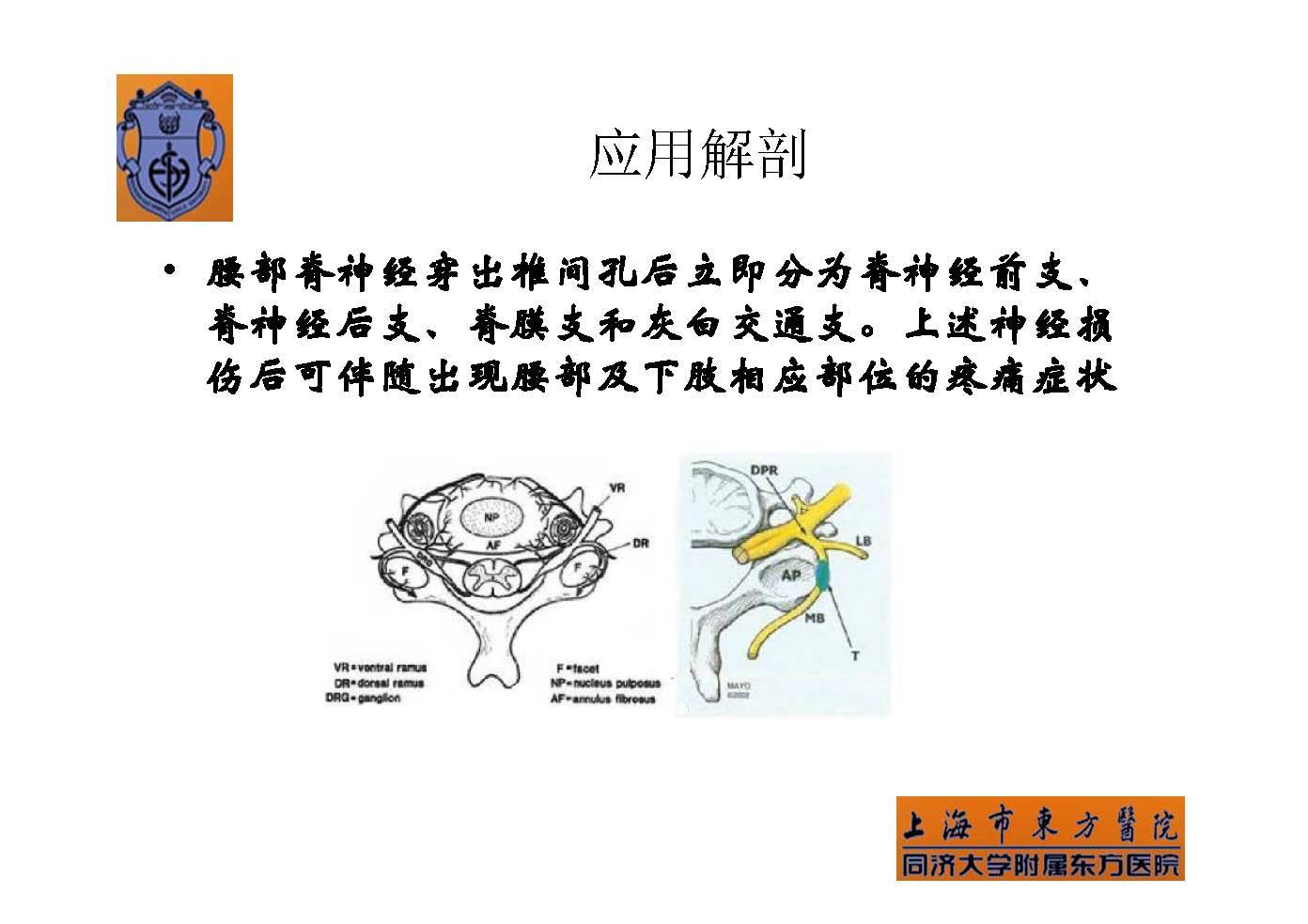 实用腰椎椎旁神经阻滞