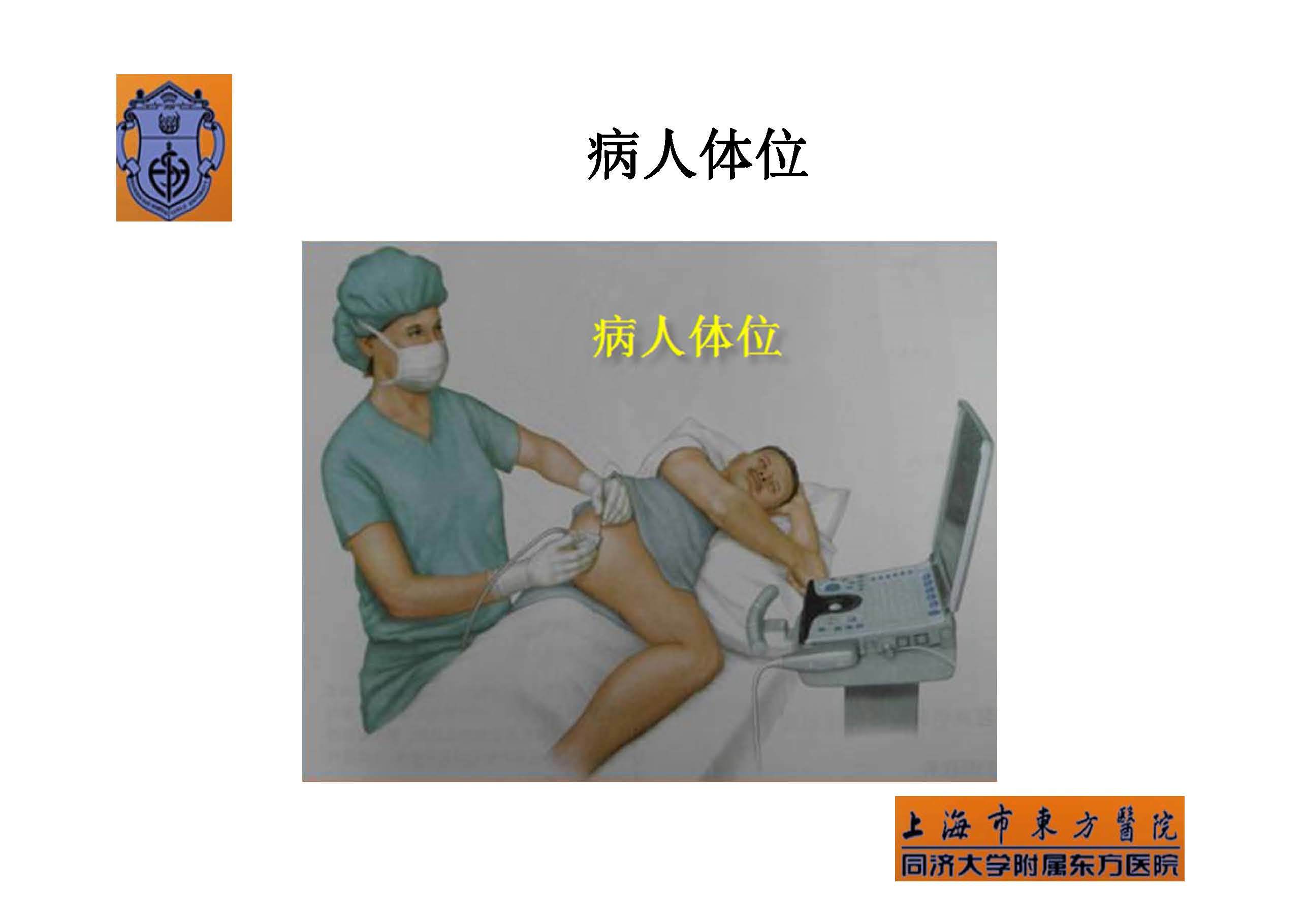 > 实用骶丛神经阻滞