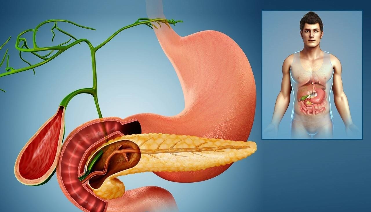 胰腺的胰管与胆总管共用一个开口(肝胰壶腹),石头若把这个开口堵了