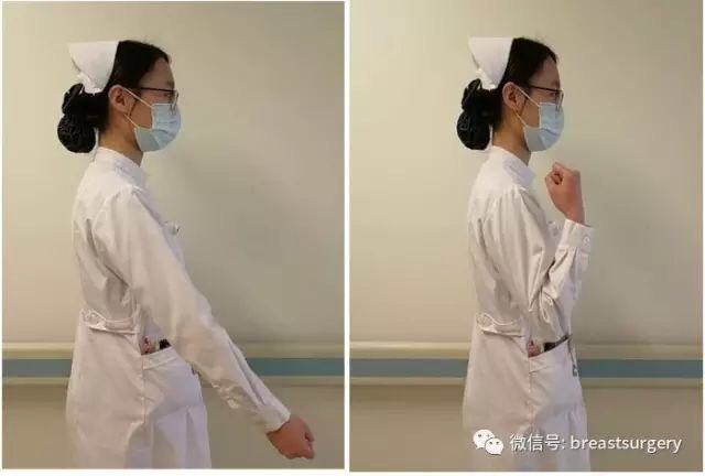 乳腺癌术后患侧上肢功能锻炼