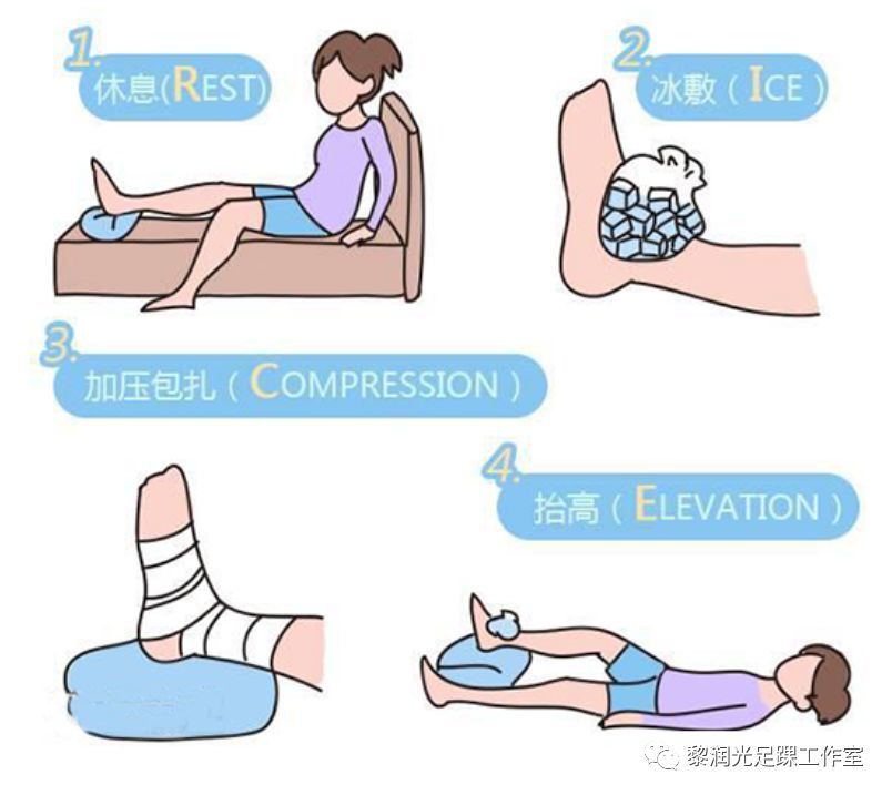脚踝扭伤(俗称崴脚)怎么办?10条解答帮到你!