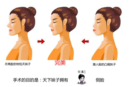 凸嘴、地包天,你需要做颌面矫正改轮廓