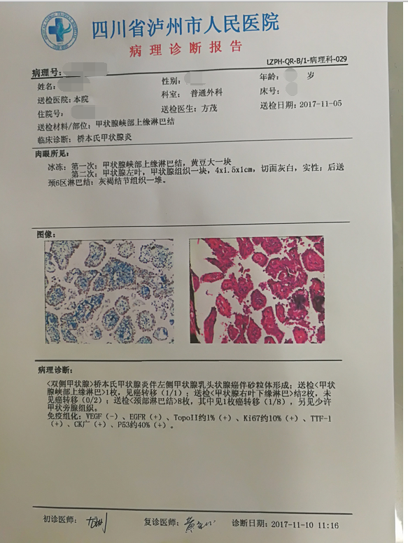 甲状腺手术图片