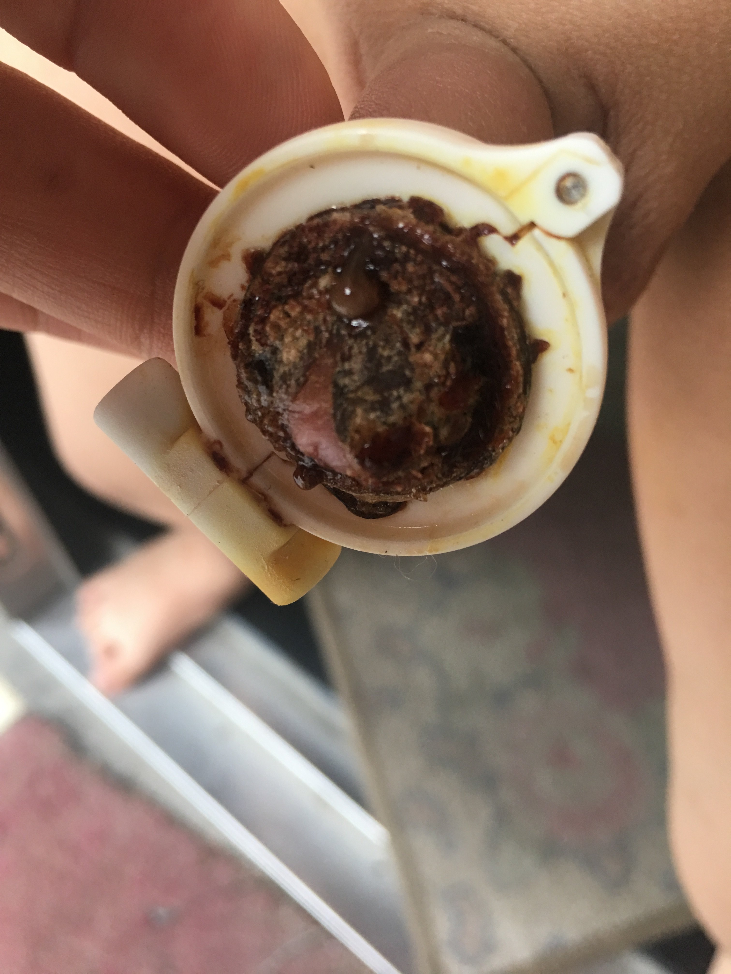 包皮粘连恢复过程