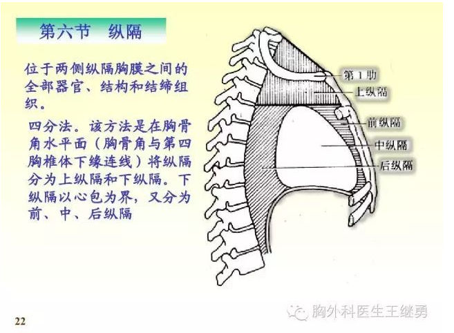 纵隔肿瘤怎么治?