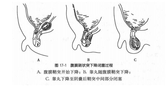 "鞘状突/努克管"的名字比较高冷,其实就是腹膜上突出的一条连接腹腔和