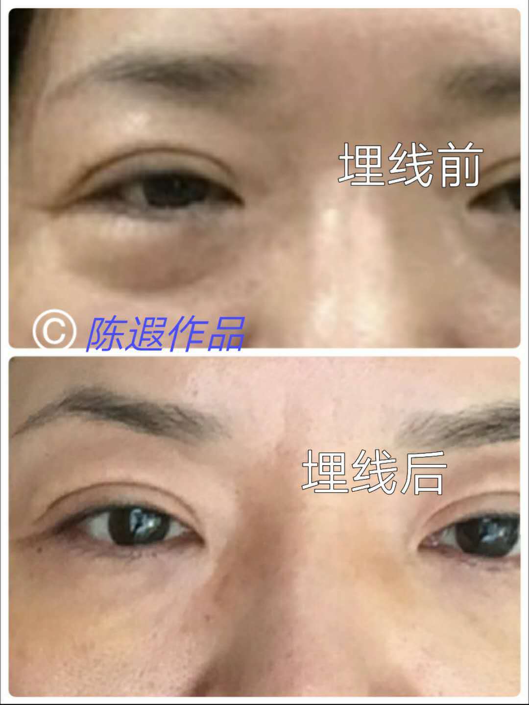 认识黑眼圈