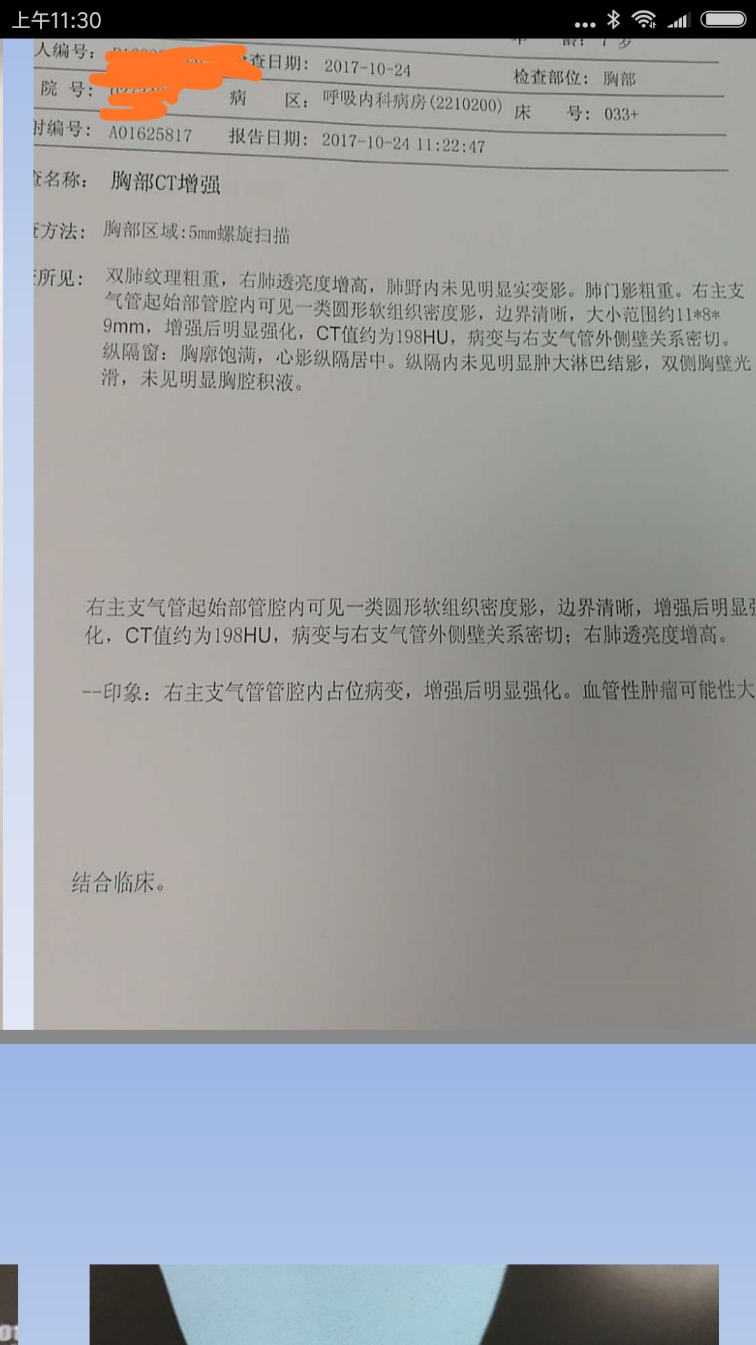 发现右侧支气管有问题反复咳喘,按哮喘治疗效果不好,检查胸部ct