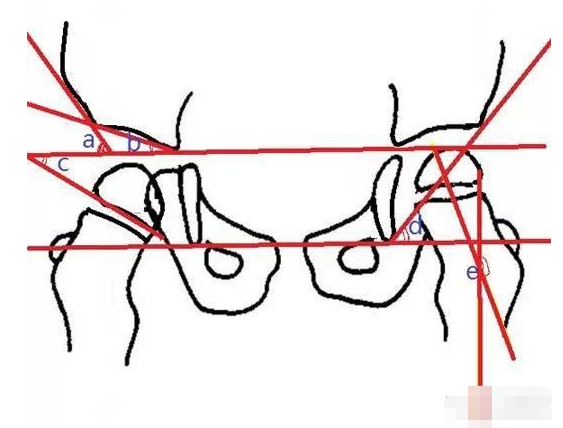 据说只有 1% 骨科医生能读懂骨盆 X 线,不信你