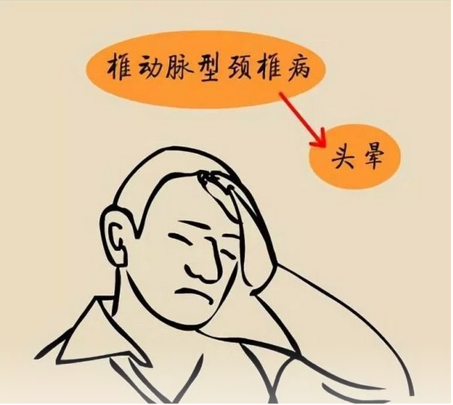 旋颈诱发试验阳性(颈椎向左或向右旋转时症