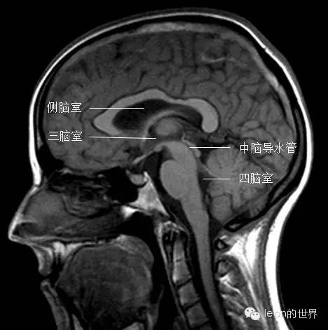 史上最全三脑室解剖图谱