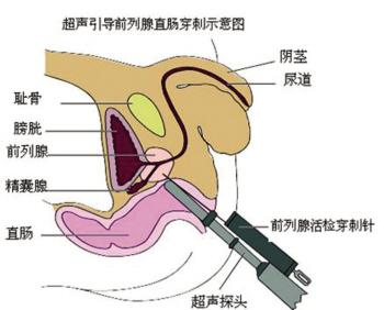 3,前列腺的位置?