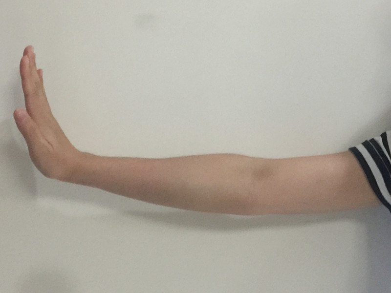 腕关节屈曲运动