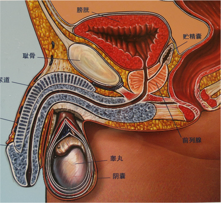 前列腺炎的诊断治疗及其对性功能和生育的影响