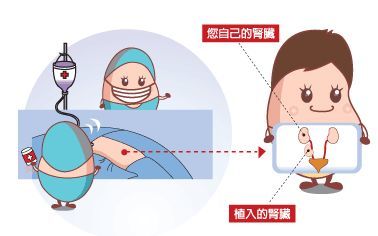 肾移植_肾移植手术 好大夫在线