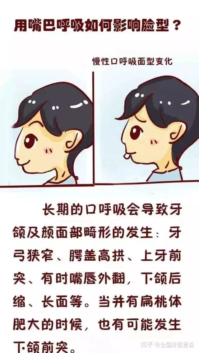 小贝告诉大家一个很重要的原因"口呼吸"面型上看也没有小时候漂亮