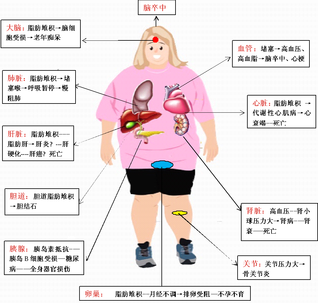 图2:肥胖的危害示意图