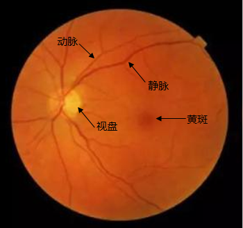 眼底其实是眼球内后部的组织,即眼球的内膜——视网膜,视乳头,黄斑和
