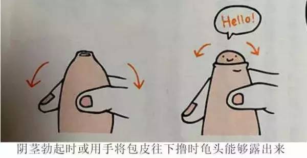 男孩子小鸡鸡那些事儿一